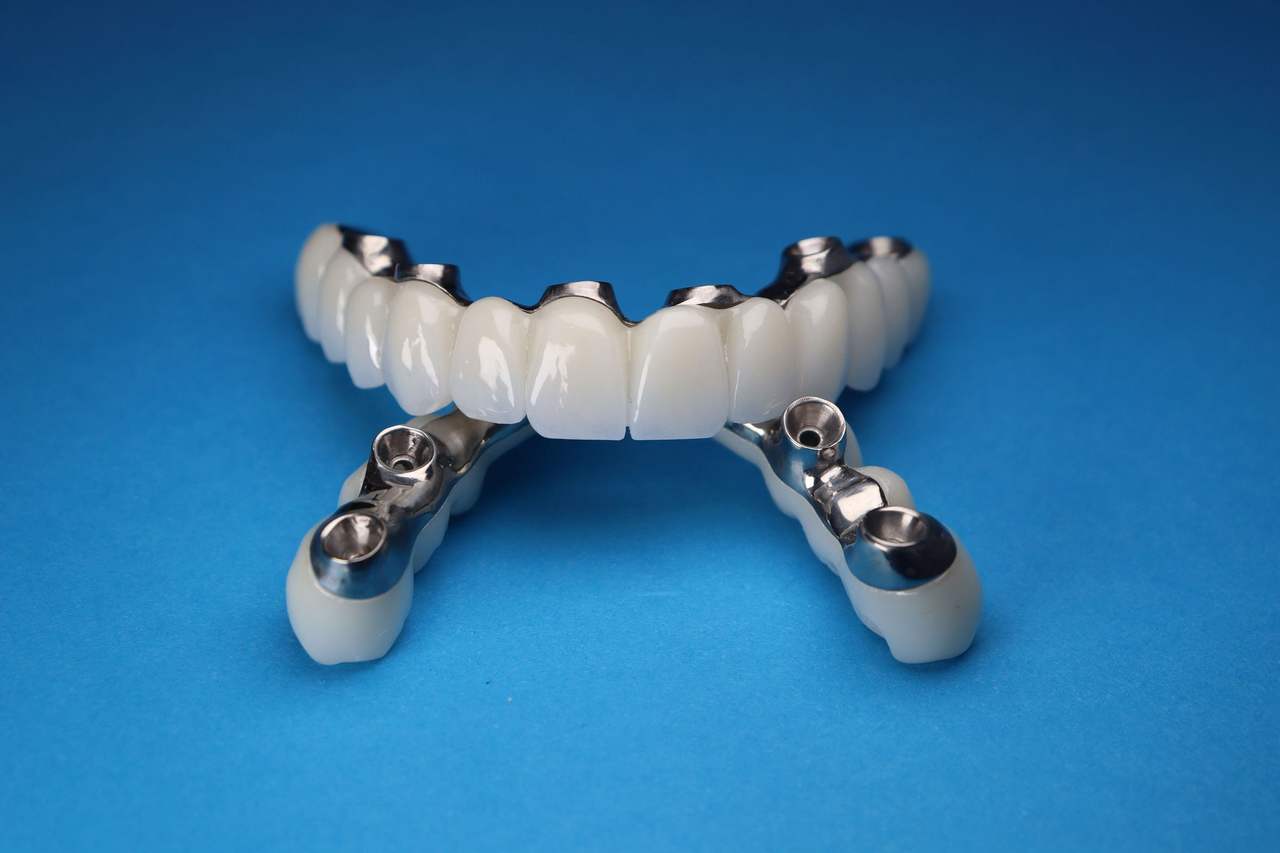 Hai hàm phục hình bắt vít trên implant, răng sứ trắng trên khung kim loại có lỗ vít, đặt trên nền xanh dương